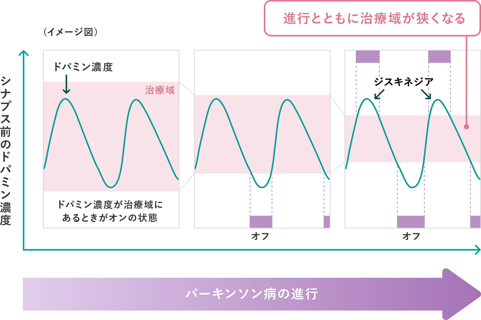 運動合併症（ウェアリングオフ、ジスキネジア） | 病気を知る | PDネット